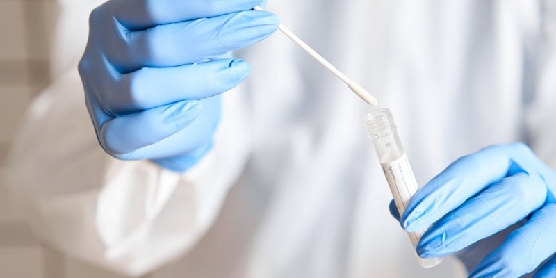 Atualmente, a Secretaria de Saúde do Recife tem capacidade para realizar 11.700 testes rápidos de antígeno por dia