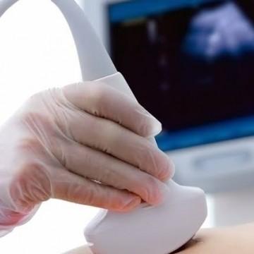Caruaru dá início a mutirão para realização de ultrassonografias