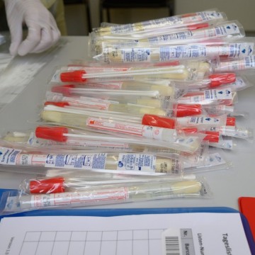 Estado promete aumentar testes para casos leves de covid-19