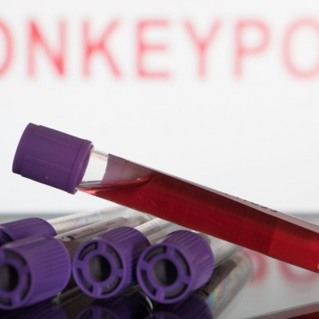 Monkeypox: Pernambuco tem 15 casos confirmados; outras 132 notificações seguem em investigação
