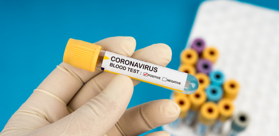 Brasil tem 188.974 casos confirmados de coronavírus