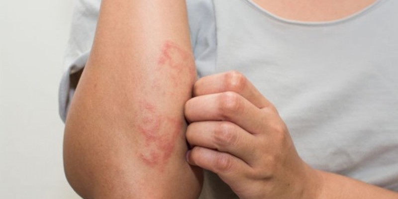 Dermatologista esclarece medidas que devem ser tomadas, caso aconteça penetração da substância na pele