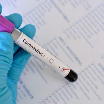 Pesquisa aponta que pelo menos 52 mil pessoas já tenham tido o novo coronavírus no Recife 