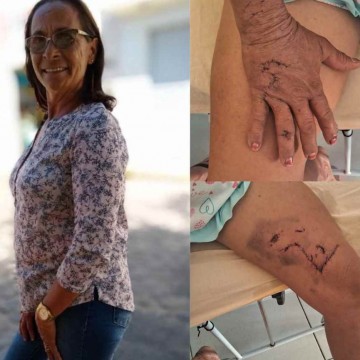 Agricultora de 58 anos é atacada por onça-parda no Sertão do Estado