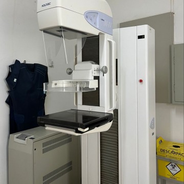 Governo Raquel Lyra inicia processo de compra de 20 mamógrafos digitais com investimento previsto de R$ 27 milhões