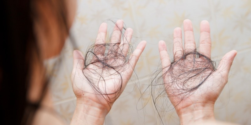 Tem se tornado cada vez mais frequente a queda de cabelo em pacientes que tiveram a doença
