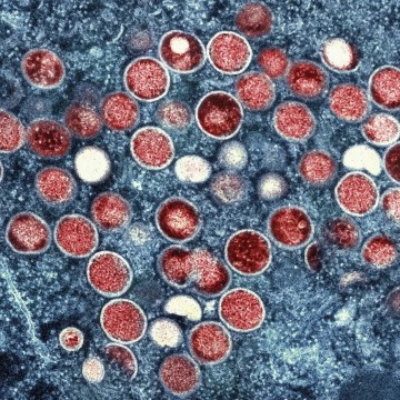 Vacinação contra a mpox começa em março