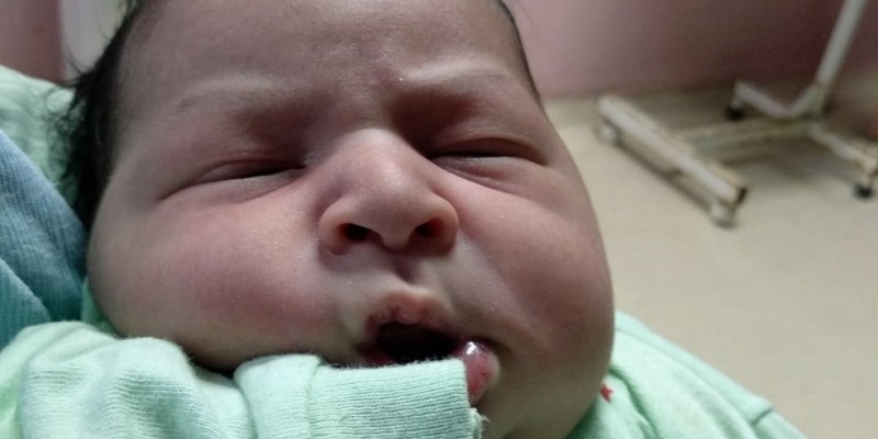 O parto ocorreu na última quarta (28) no Hospital Barão de Lucena, zona oeste do Recife. 