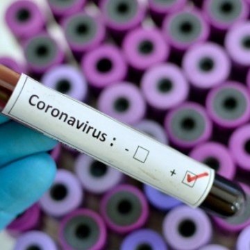 Três mortes são registradas por coronavírus em Pernambuco