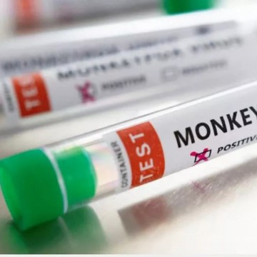 Pernambuco tem 13 confirmações e 33 casos em investigação da Monkeypox