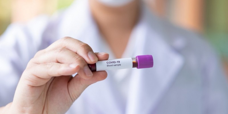 O teste sorológico para o novo coronavírus era feito desde o fim de junho e está em análise pela Agência Nacional de Saúde Suplementar que conseguiu derrubar liminar que obrigava o procedimento