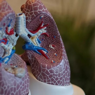 Agosto Branco chama atenção para o câncer de pulmão