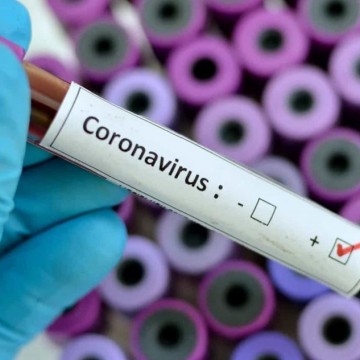  ‘O vírus não está indo embora’, diz secretário estadual de saúde