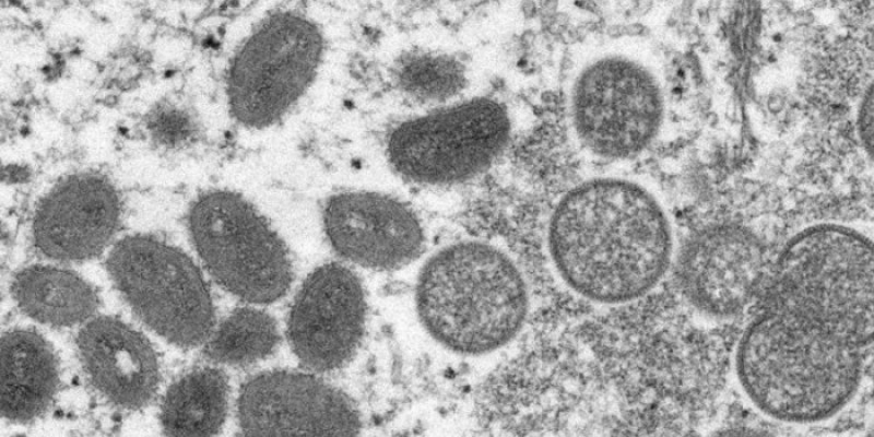 Do total das notificações, treze pacientes tiveram confirmação laboratorial para o vírus