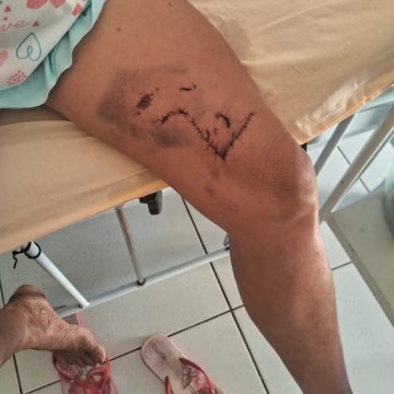 Mulher é atacada por onça-parda no Sertão de Pernambuco