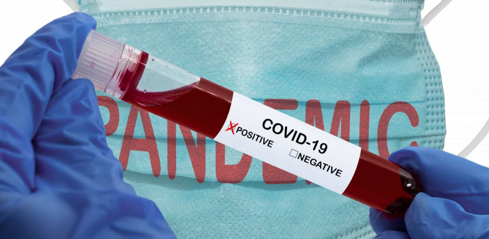 Brasil tem 800 mortes por coronavírus