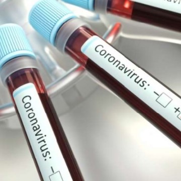 Brasil tem mais de um milhão de infectados pelo novo coronavírus