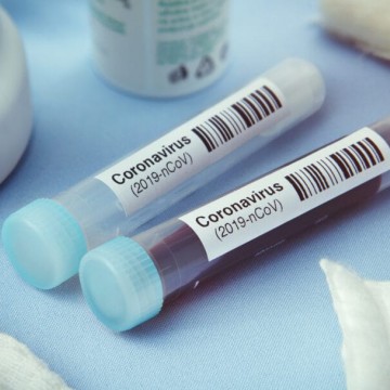  Mais duas pessoas apresentaram cura clínica do novo coronavírus em Pernambuco 
