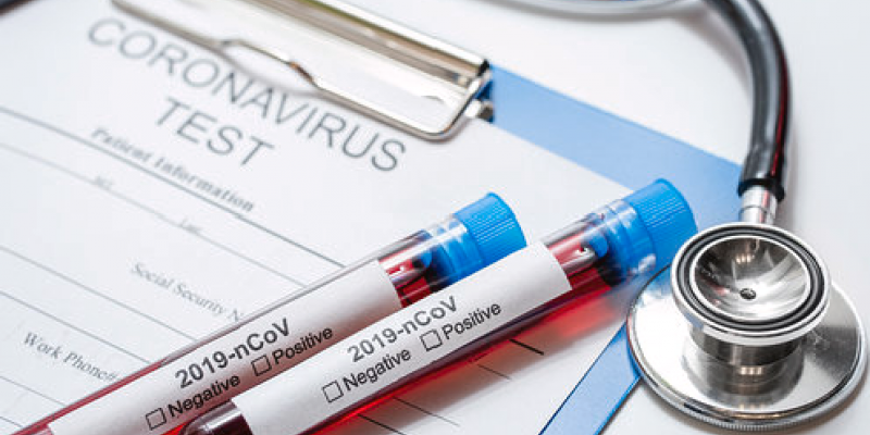 O Ministério da Saúde anunciou nesta terça-feira (14), que subiu para 1.532 o número de mortes pelo novo coronavírus no Brasil. Em 24h ocorreram 204 óbitos.   No total, o país já tem 25.262 casos de coronavírus confirmados