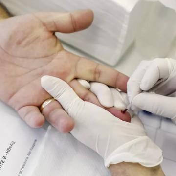 Secretaria de Saúde de Pernambuco confirma terceiro caso de Hepatite Aguda