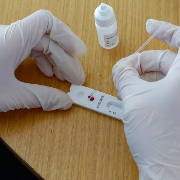 Secretaria Estadual de Saúde prepara estoque de testes de Covid-19