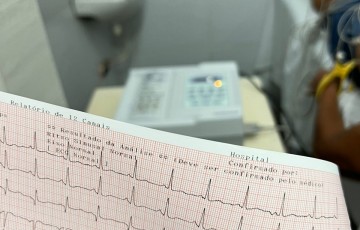Condado descentraliza exames de eletrocardiograma para as USF