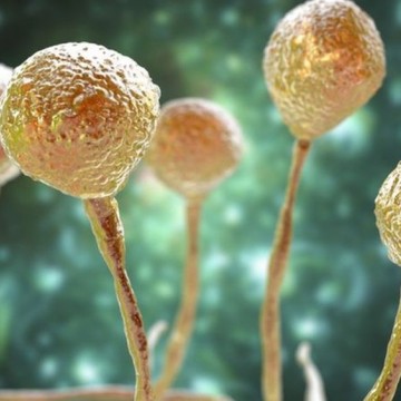 PE registra o primeiro caso de infecção por fungo negro