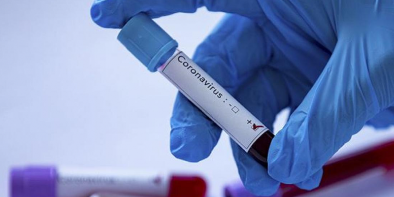 Número de testes com resultado positivo para o novo coronavírus caiu, de quinta para sexta-feira, 16%