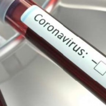 Nona morte por coronavírus acende alerta aos mais jovens 
