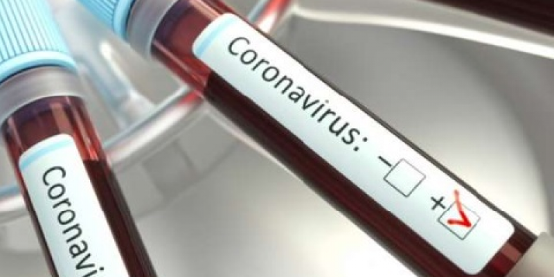 Mulher de 37 anos é a primeira paciente a morrer com Covid-19 no estado abaixo dos 60 anos