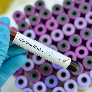Sobe para 18 o número de casos confirmados de Coronavírus em Pernambuco