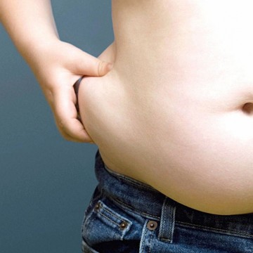 CBN Saúde: Riscos da obesidade associada à Covid-19