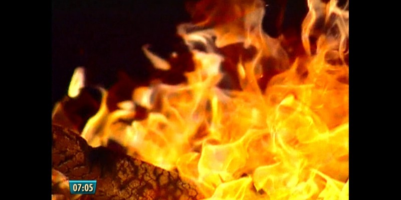Balanço final do atendimento a queimados por fogos e fogueiras durante o período junino foi apresentado no Hospital da Restauração. 