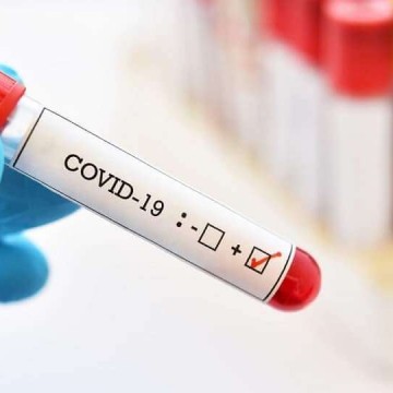 Aumento de casos da Covid-19 no Estado não significa uma segunda onda da doença, afirma SES-PE