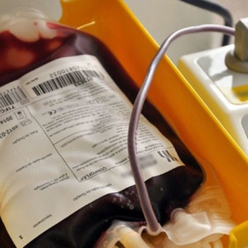 Hemope tem 40% de Redução no Estoque e pede doações de sangue à população